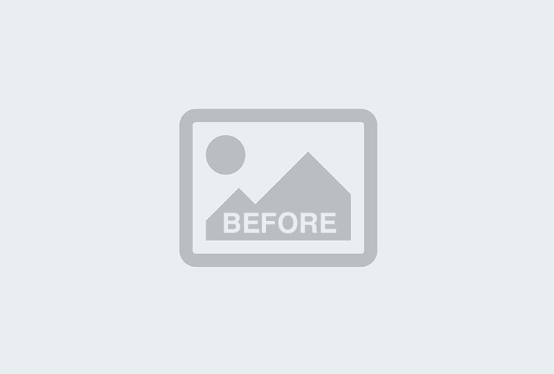 Before Image: Bella Body Lift -