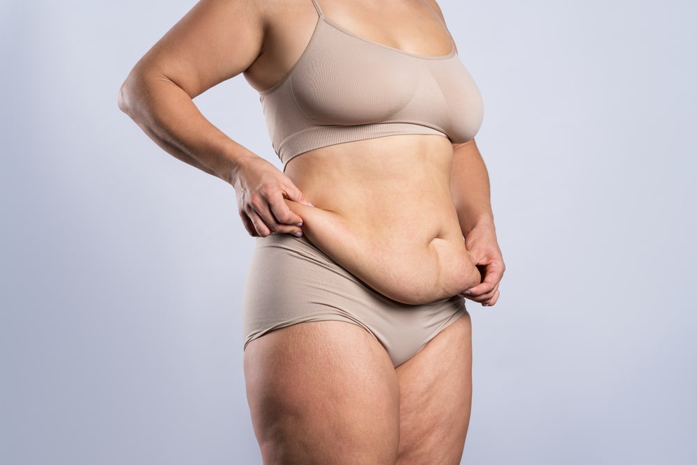 Woman's body showing some loose skin after weight loss