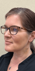 After Image: MyEllevate Minimally Invasive Neck Lift
