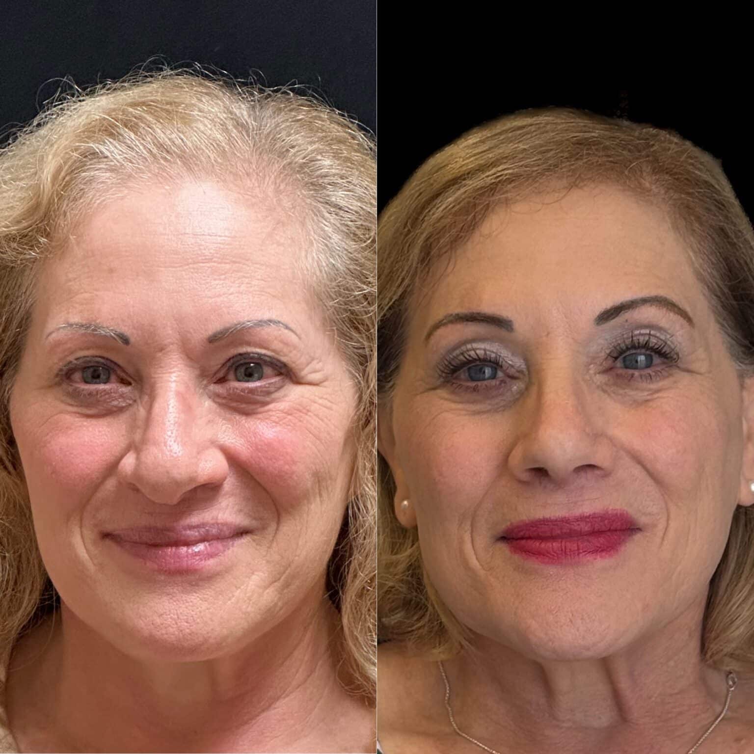 20241003 115910000 iOS