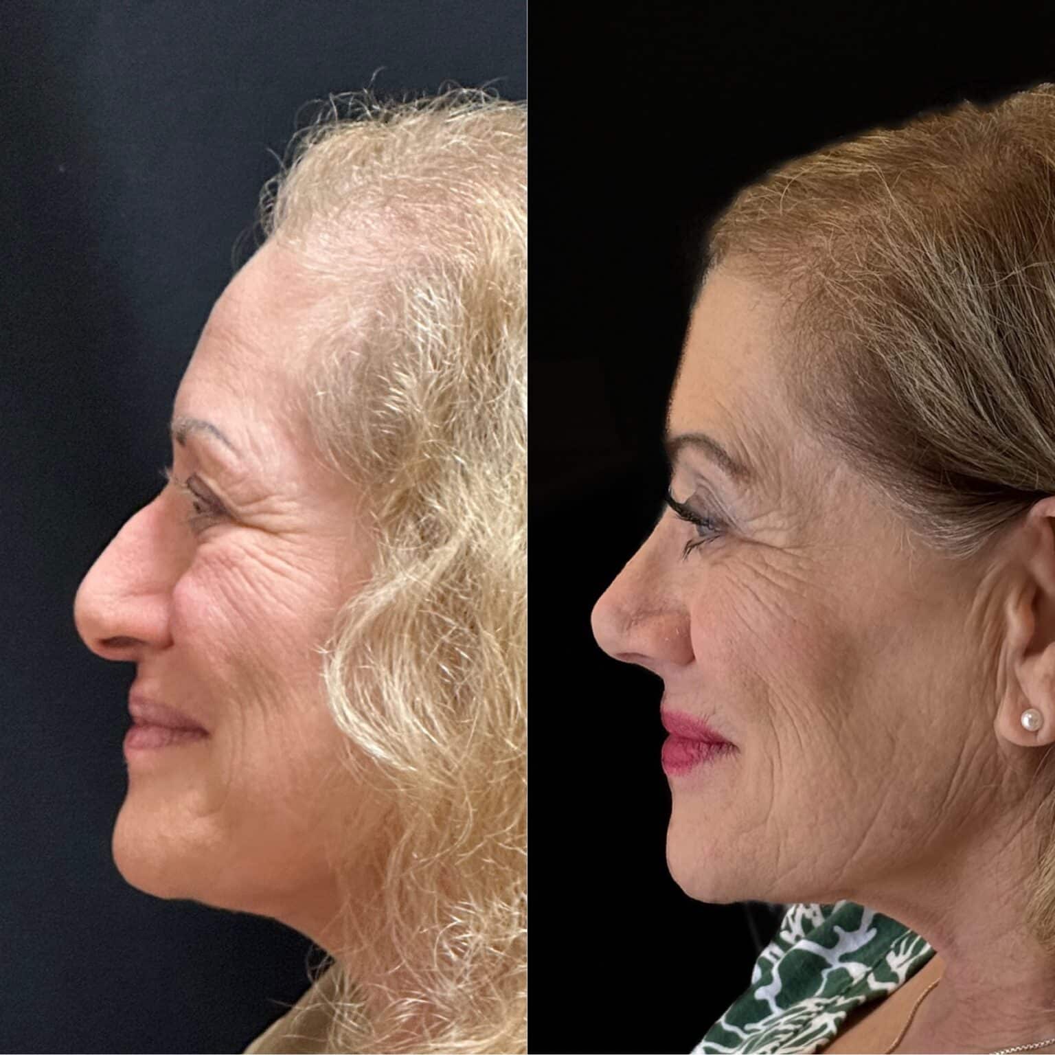 20241003 115934000 iOS