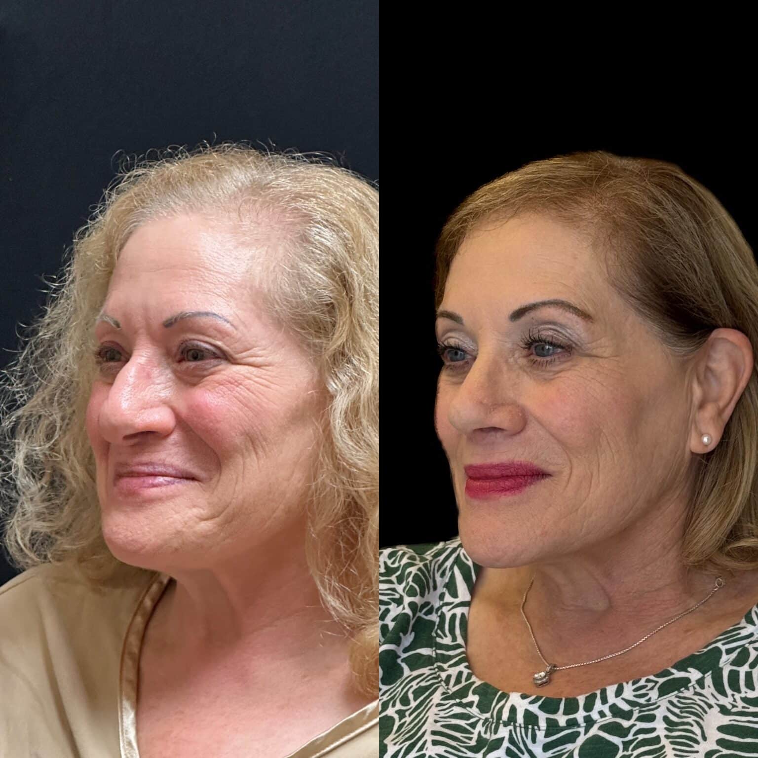 20241003 115941000 iOS