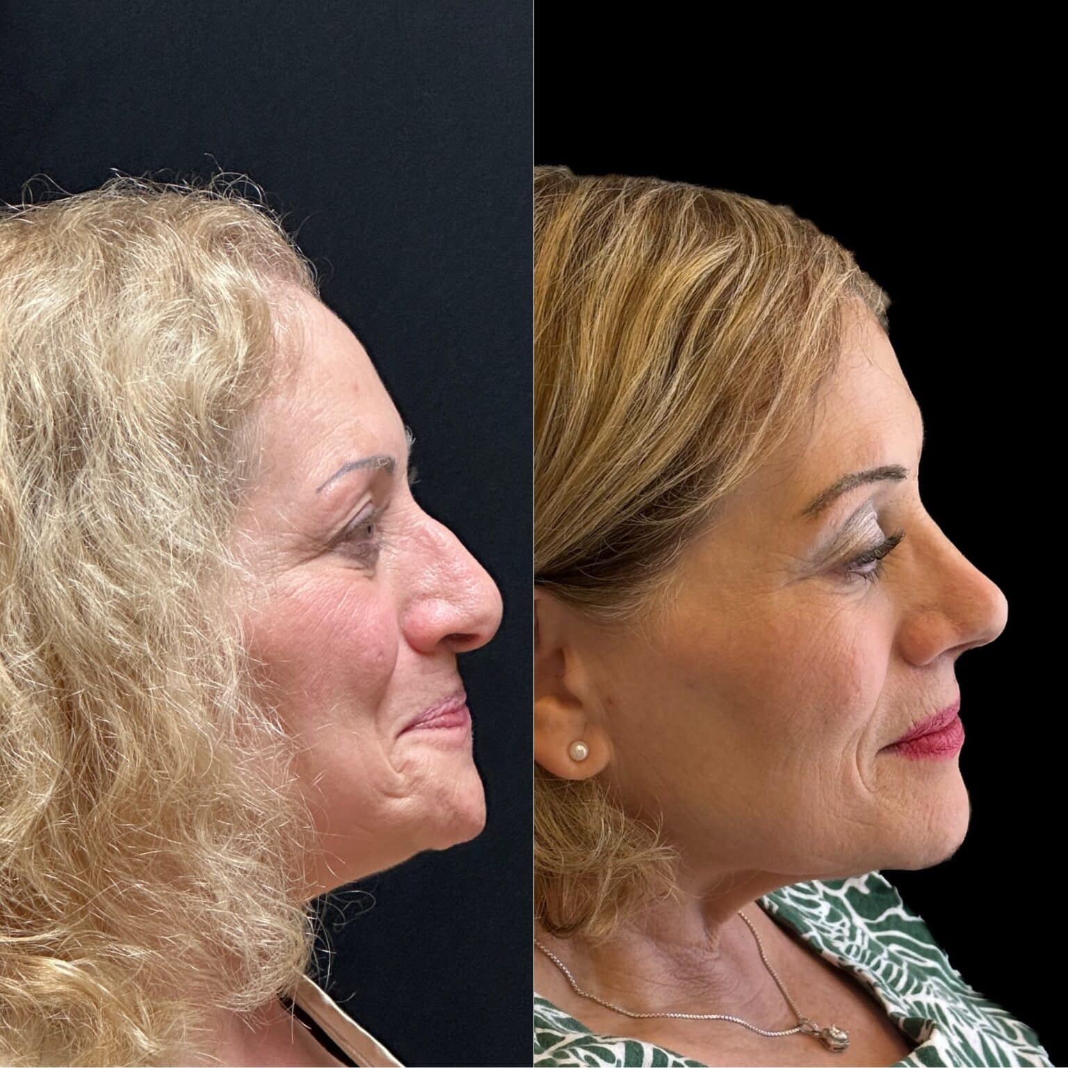 20241003 115956000 iOS