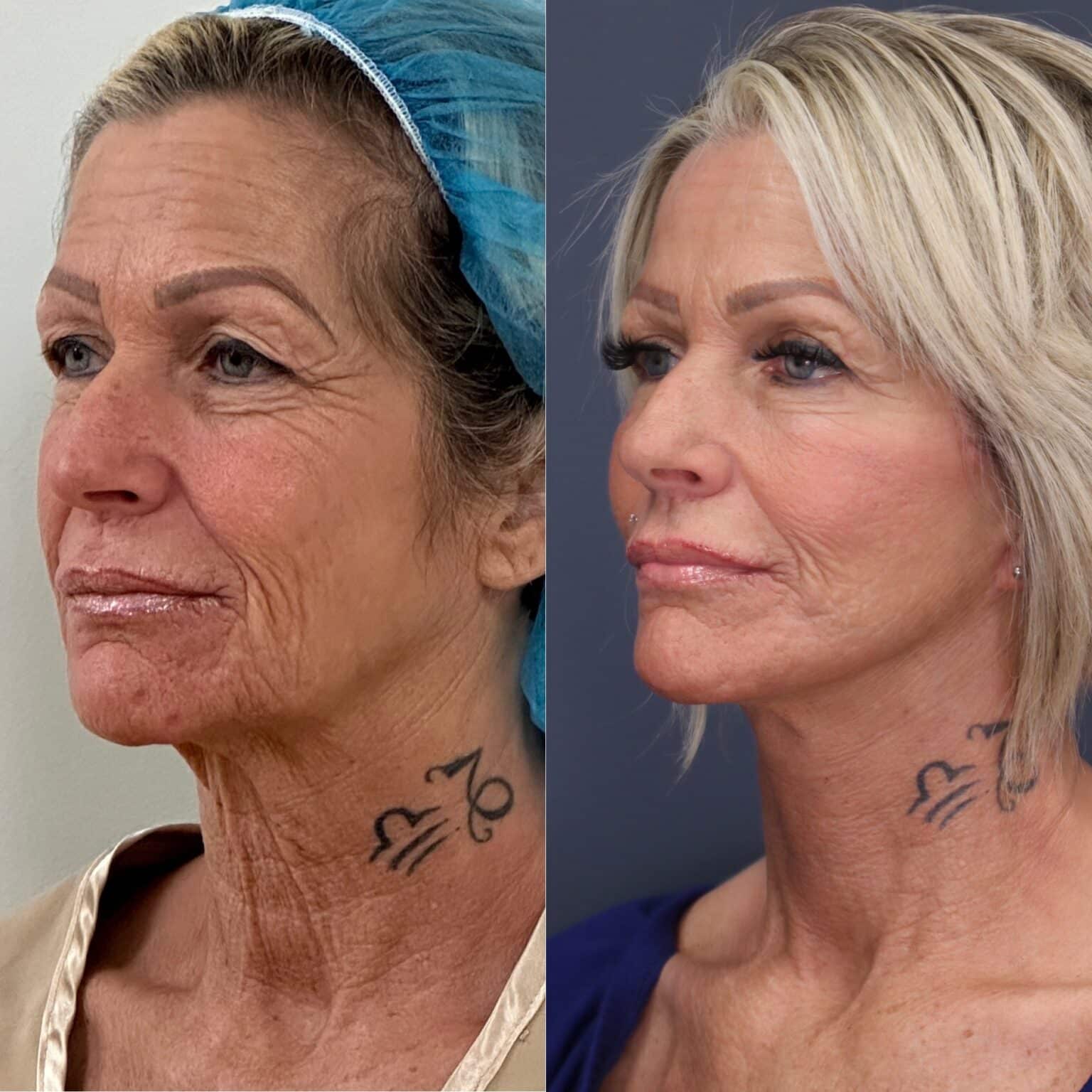 20241014 121602000 iOS