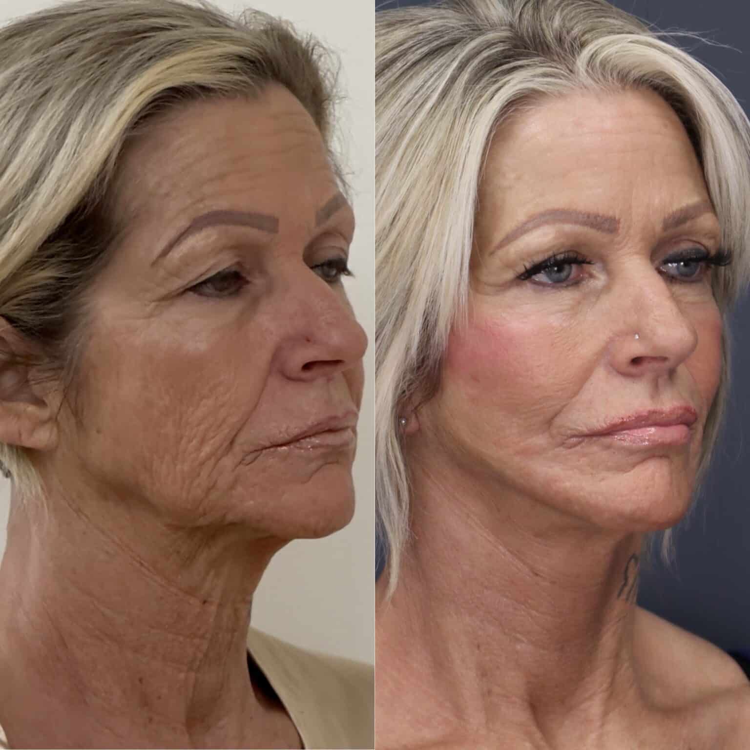 20241014 121637000 iOS