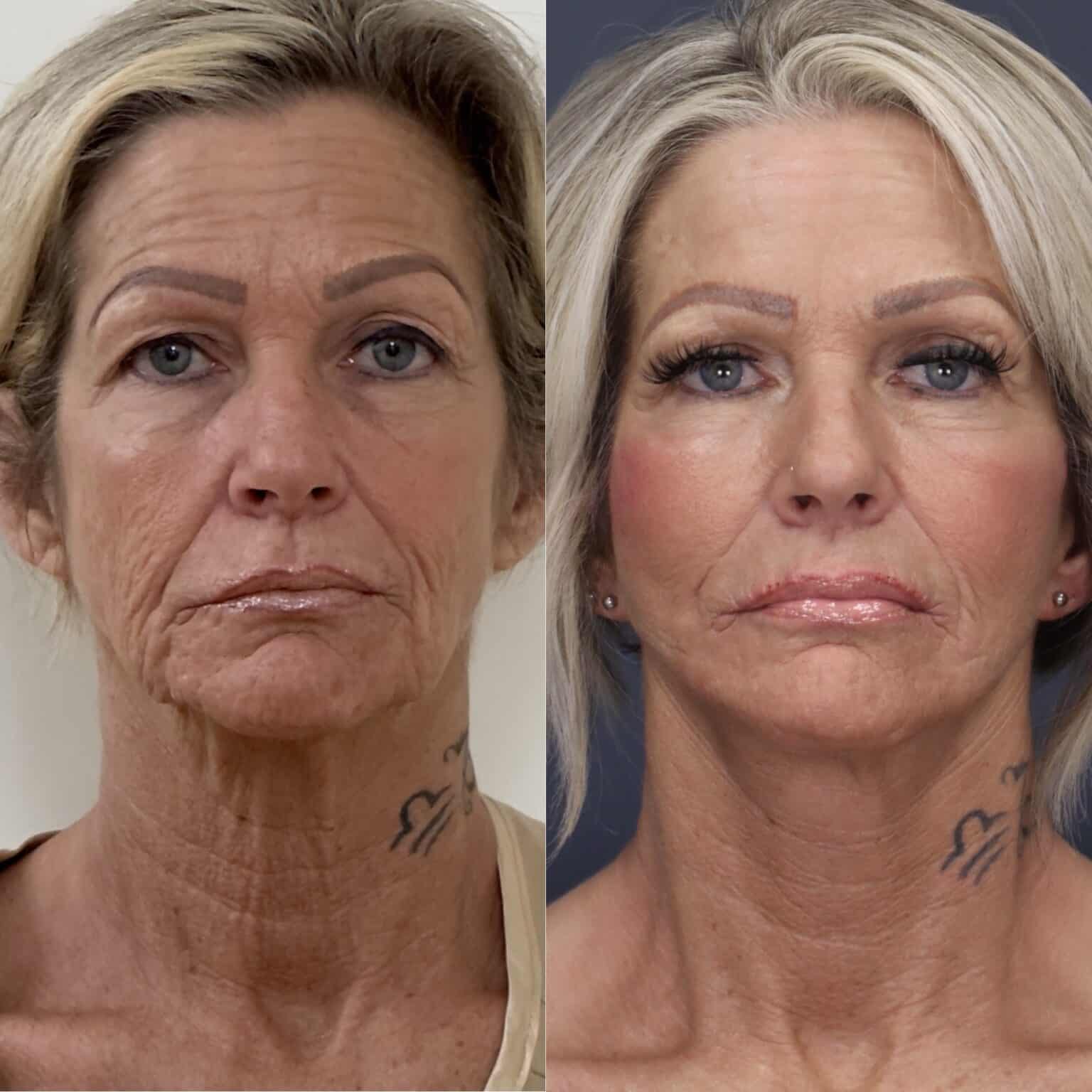 20241014 121657000 iOS