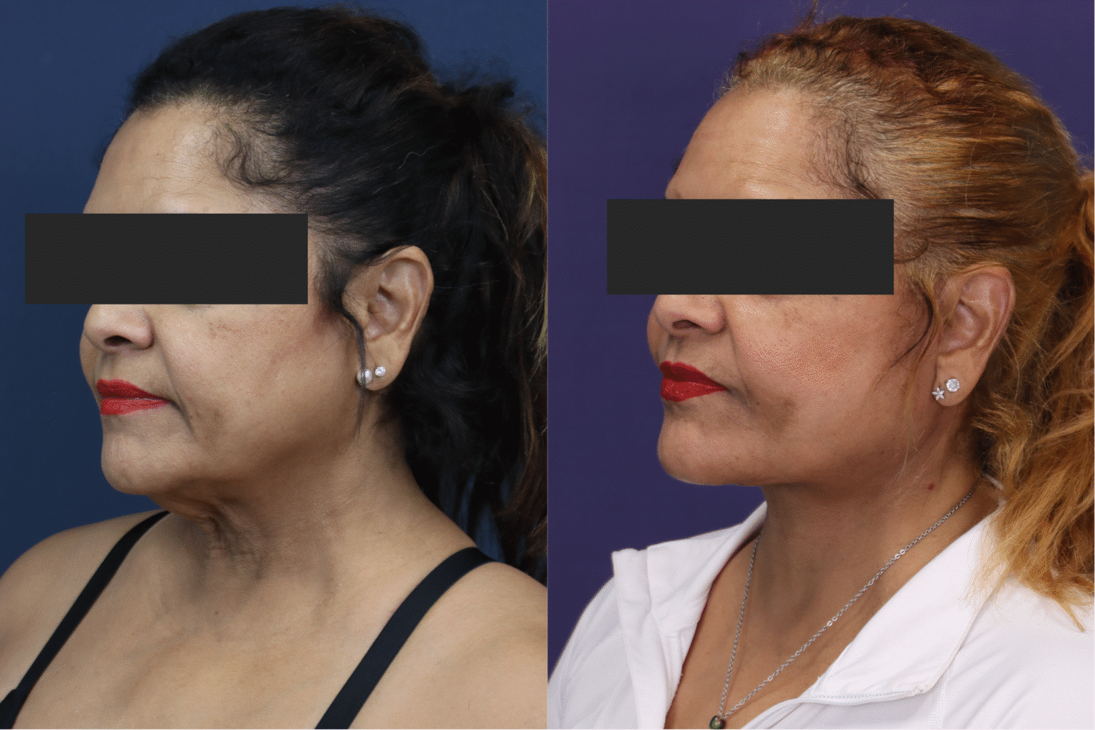 20251013 151000000 iOS