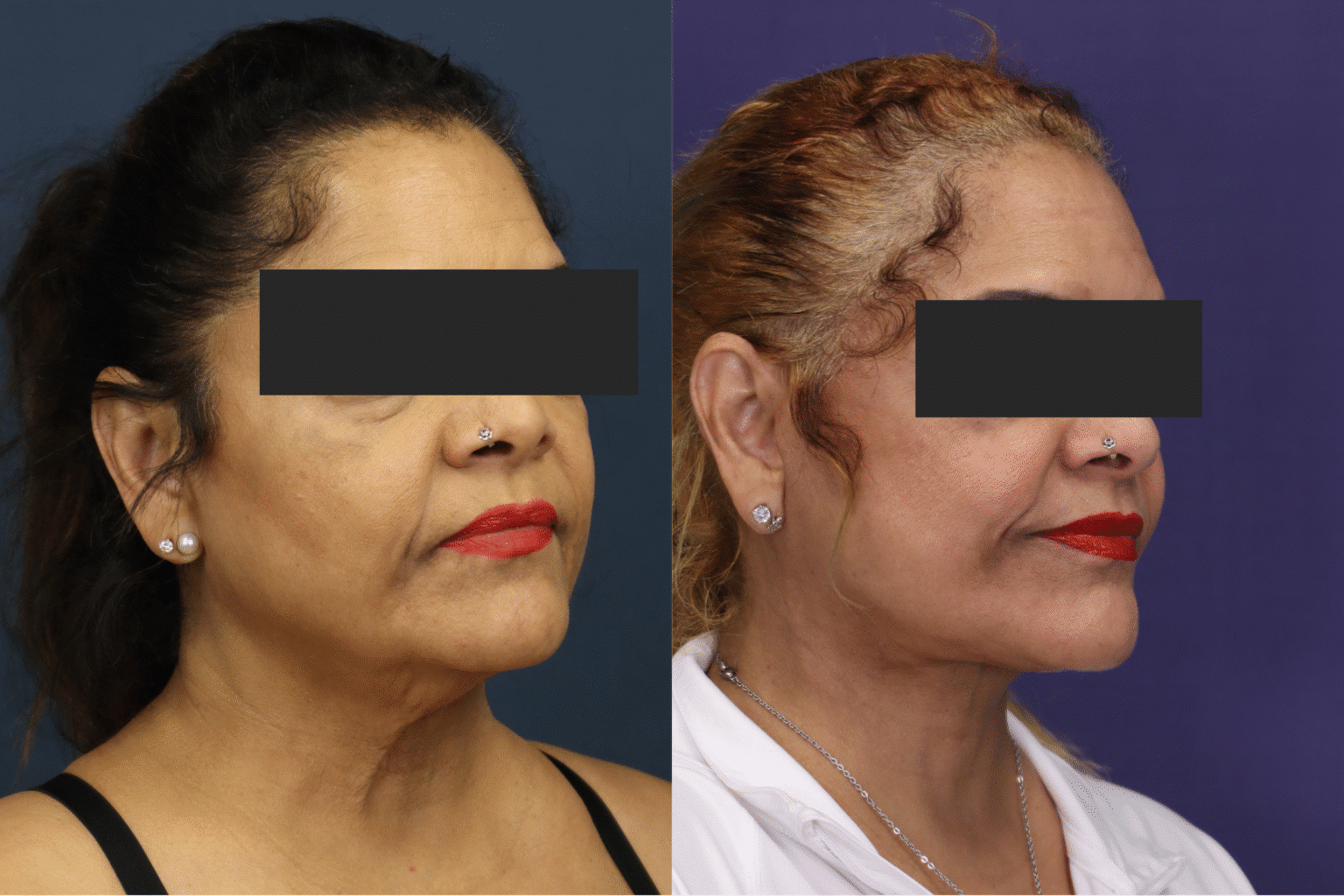 20251013 151007000 iOS