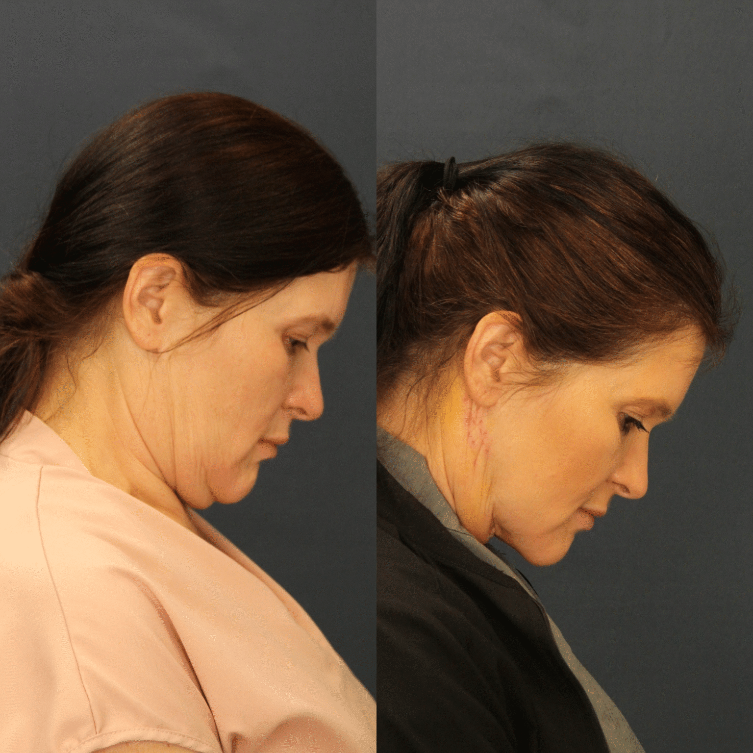 493E2D8D 093A 4D59 8D4C 8D9CBE16B9ED