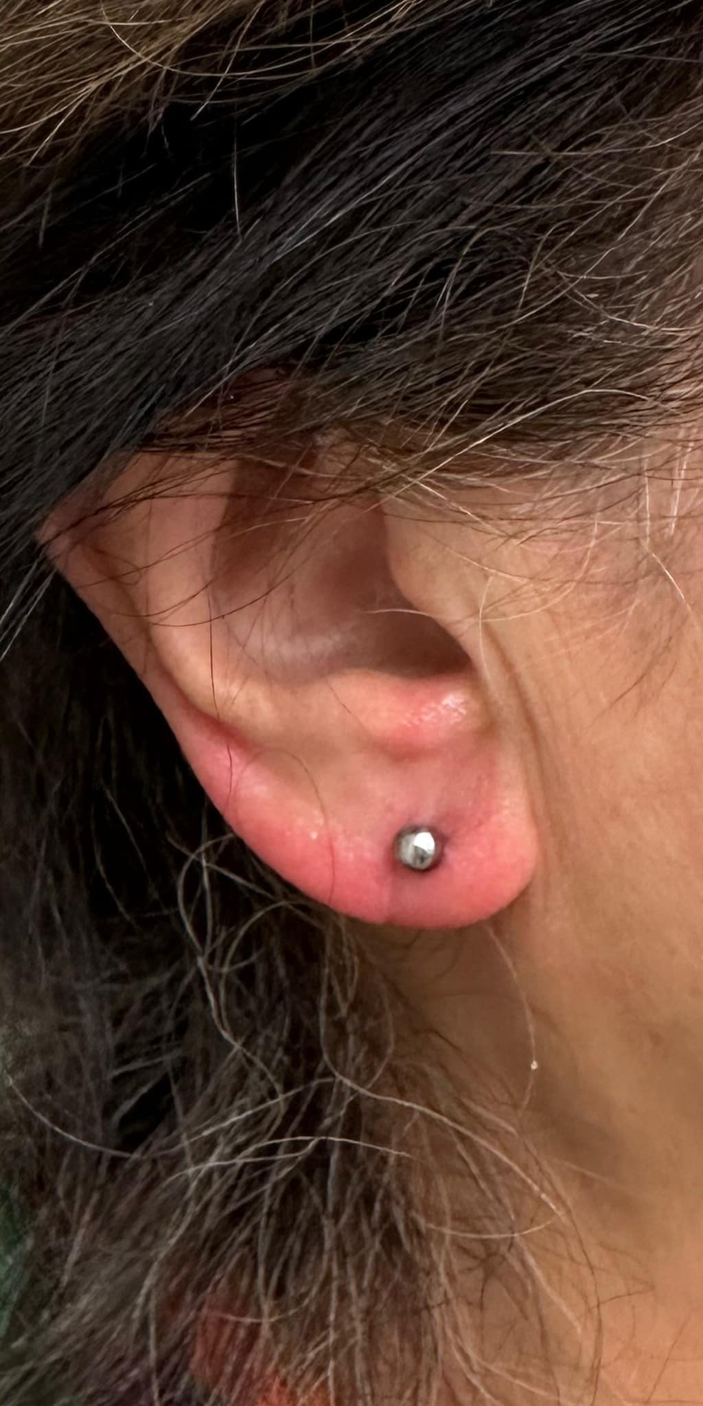 After Image: Earlobe repair