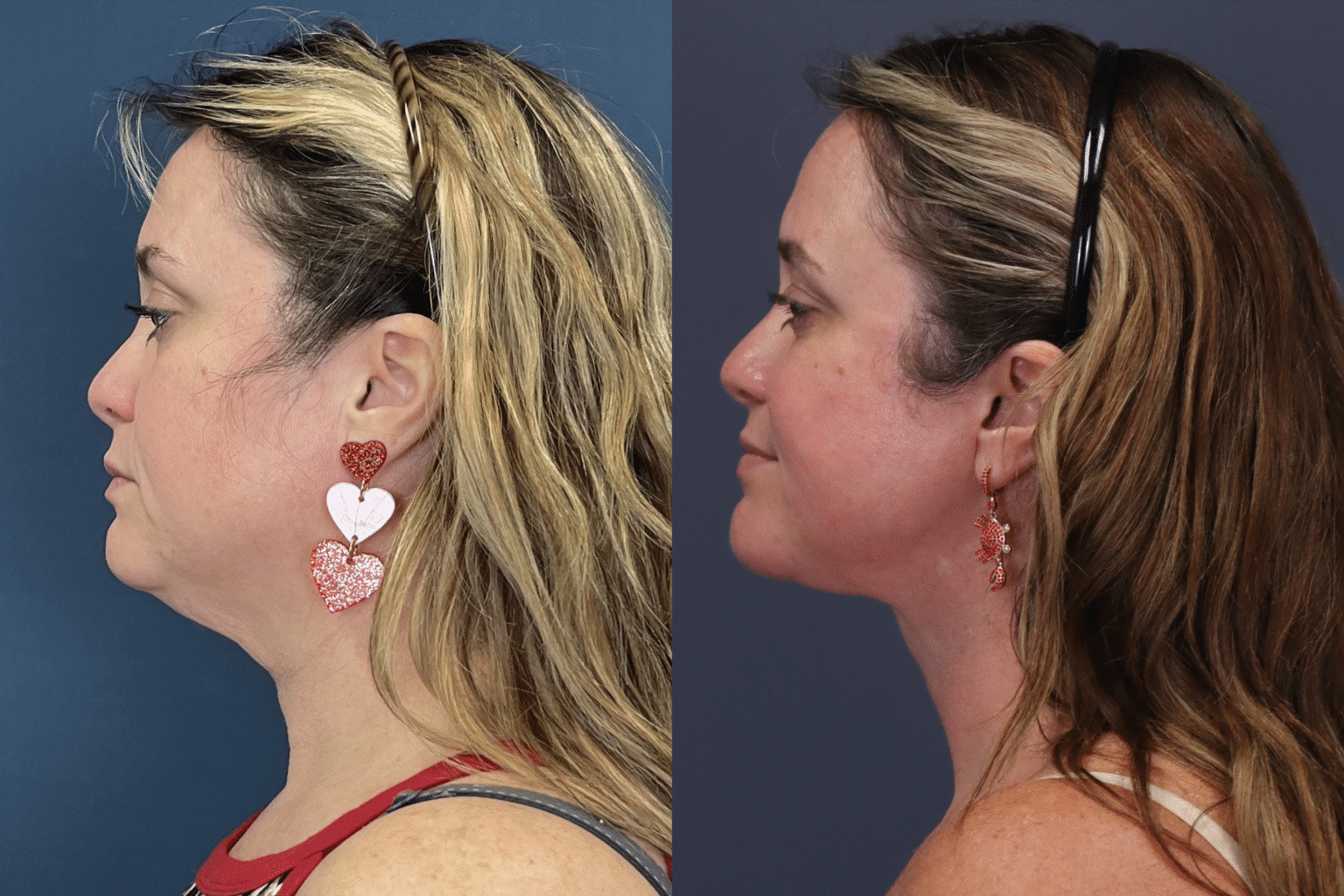 ChrystieTrinidad2025 0806 004