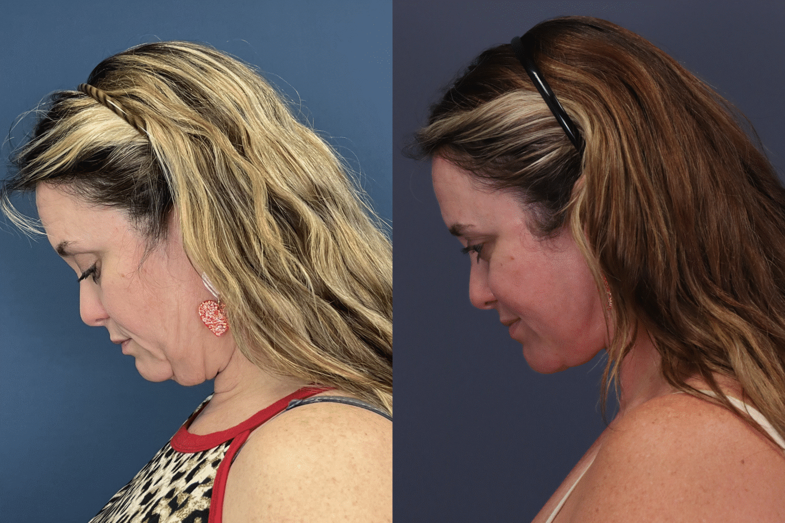 ChrystieTrinidad2025 0806 005