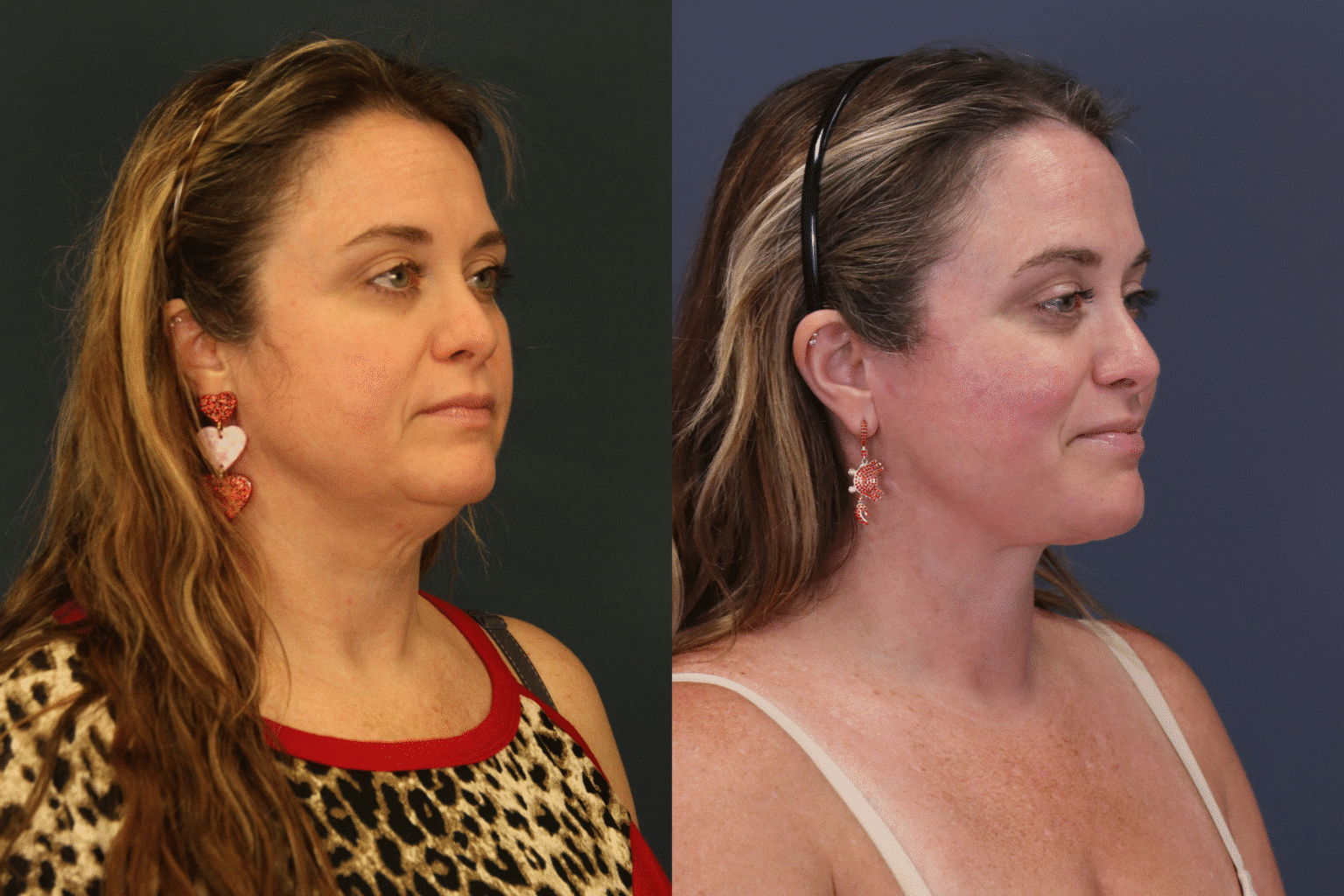 ChrystieTrinidad2025 0806 006