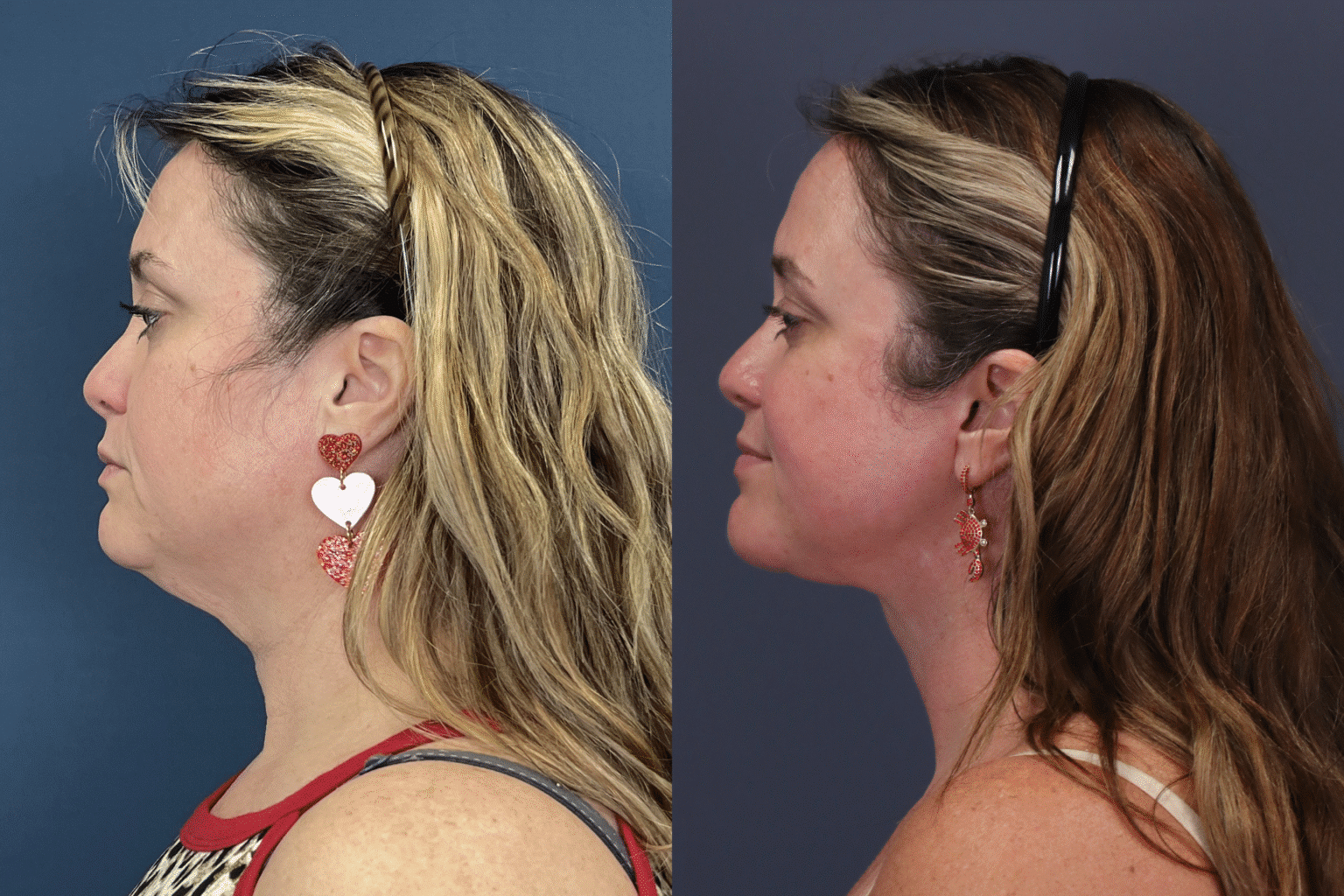 ChrystieTrinidad2025 0806 007