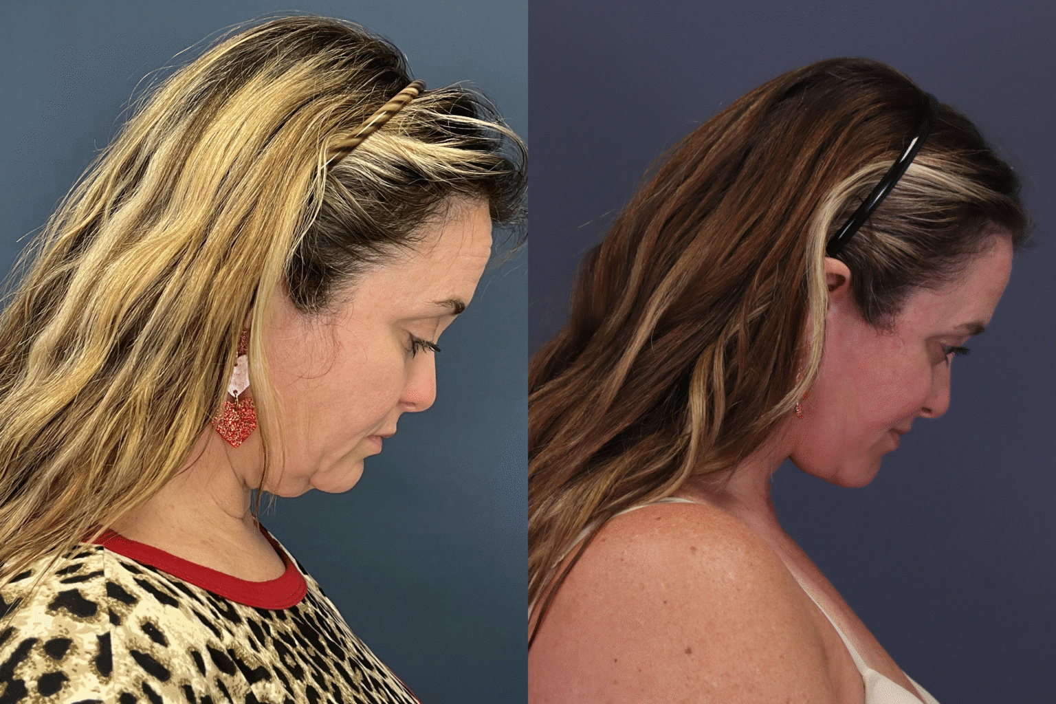 ChrystieTrinidad2025 0806 008