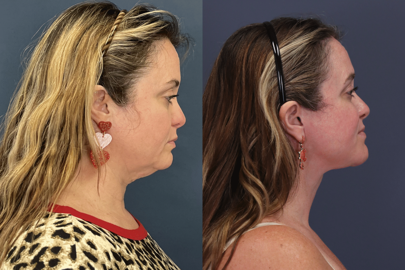 ChrystieTrinidad2025 0806 009