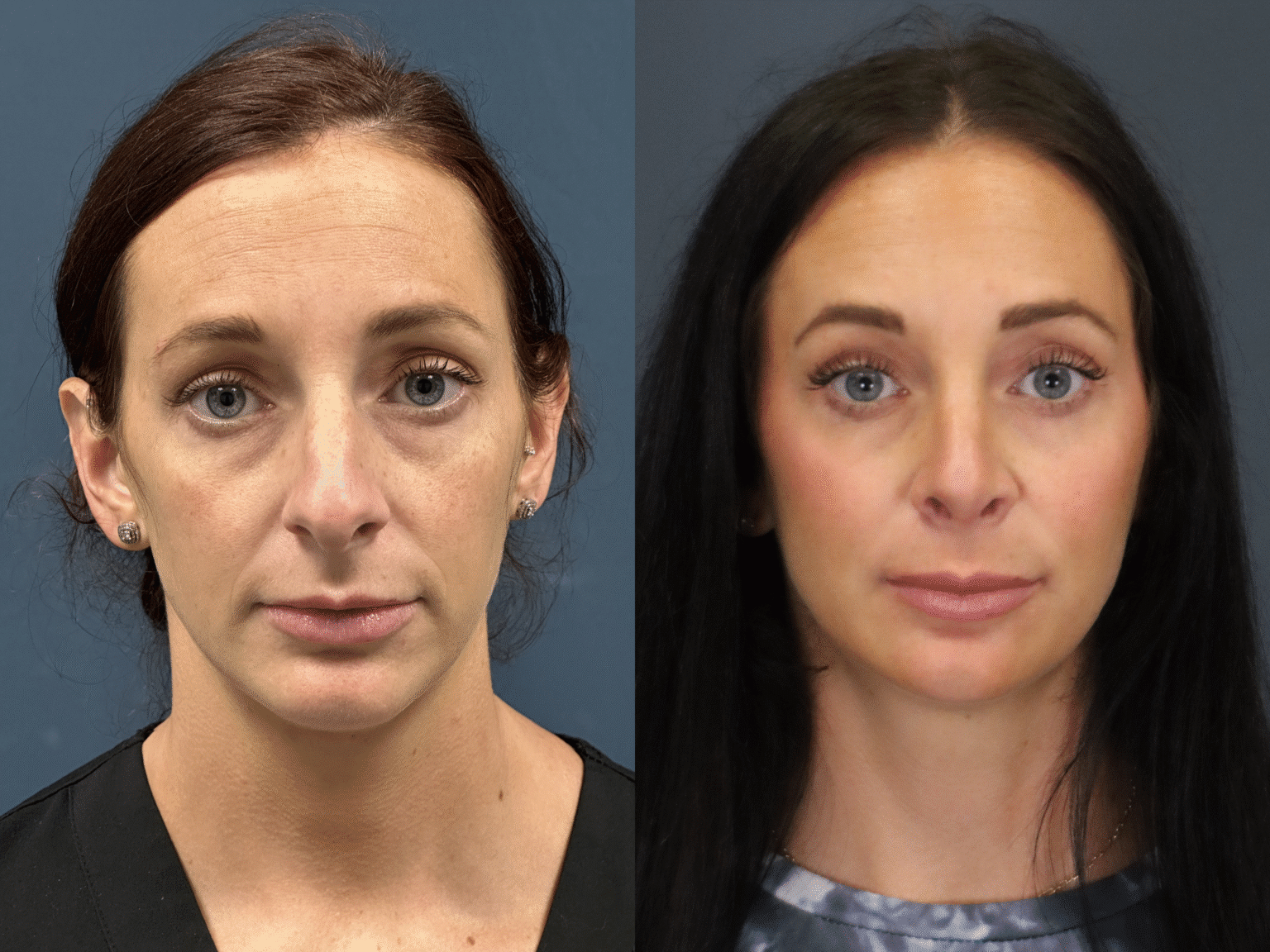 HannahCoon (Woell)2025 0513 002