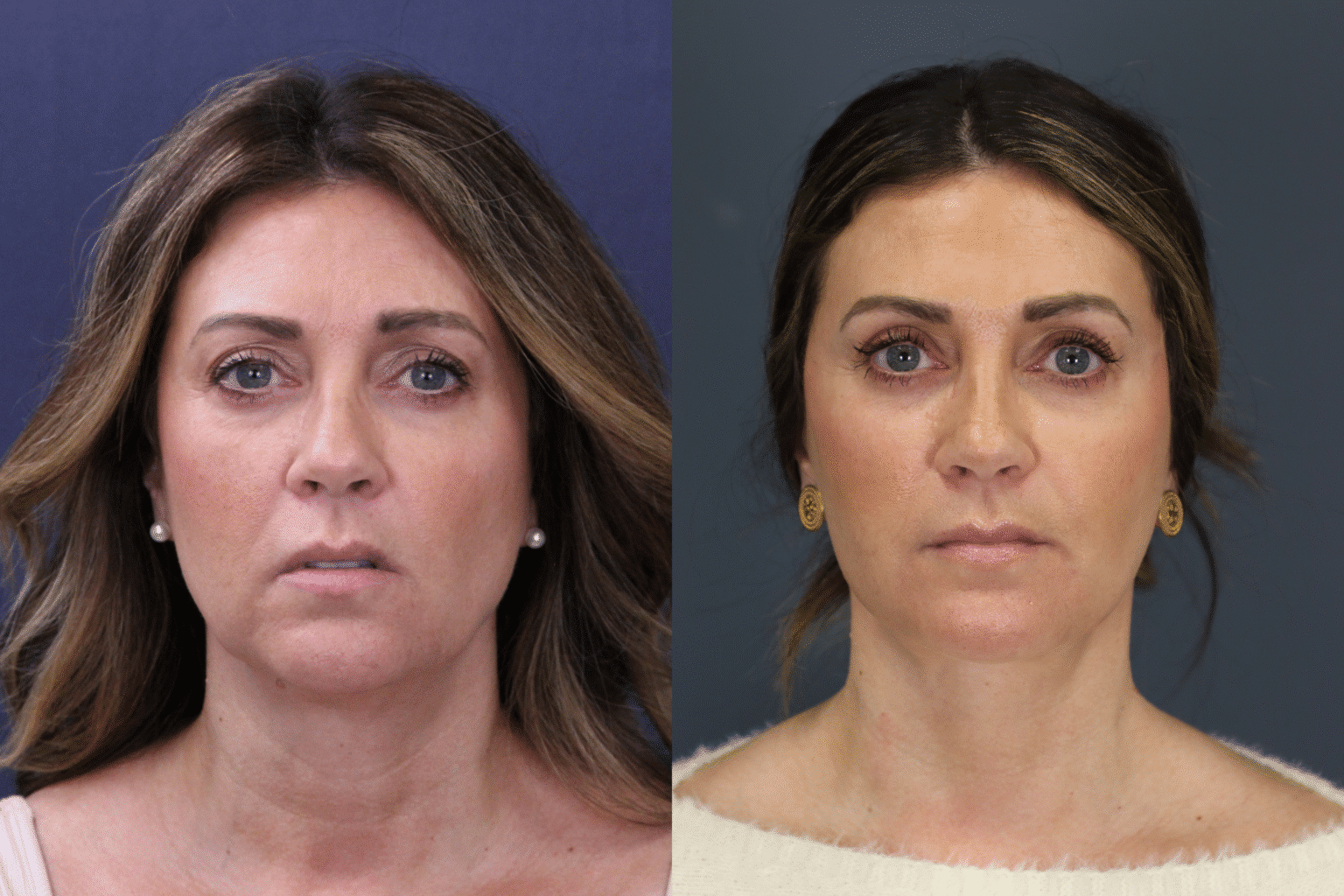 MelissaHarclerode2026 0116 008