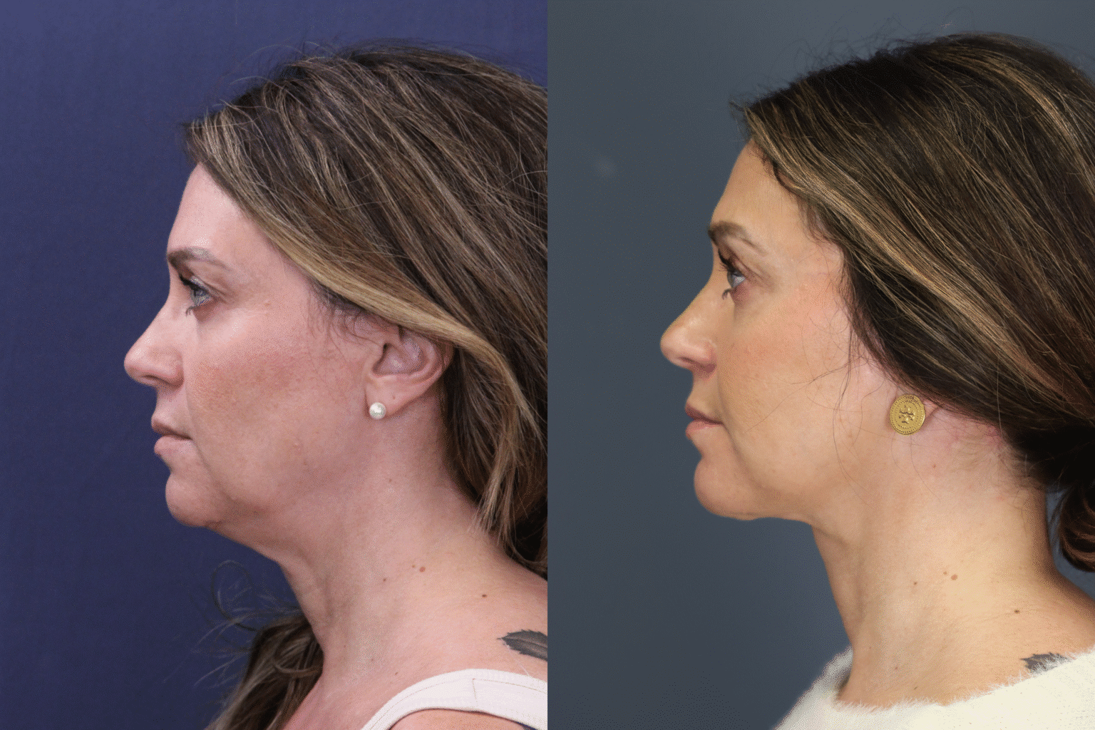 MelissaHarclerode2026 0116 009