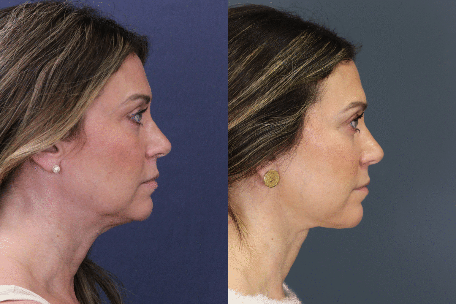 MelissaHarclerode2026 0116 010