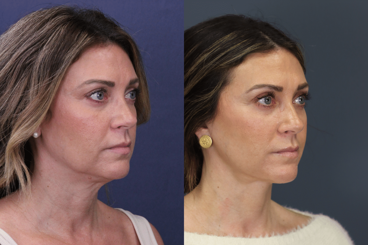 MelissaHarclerode2026 0116 012