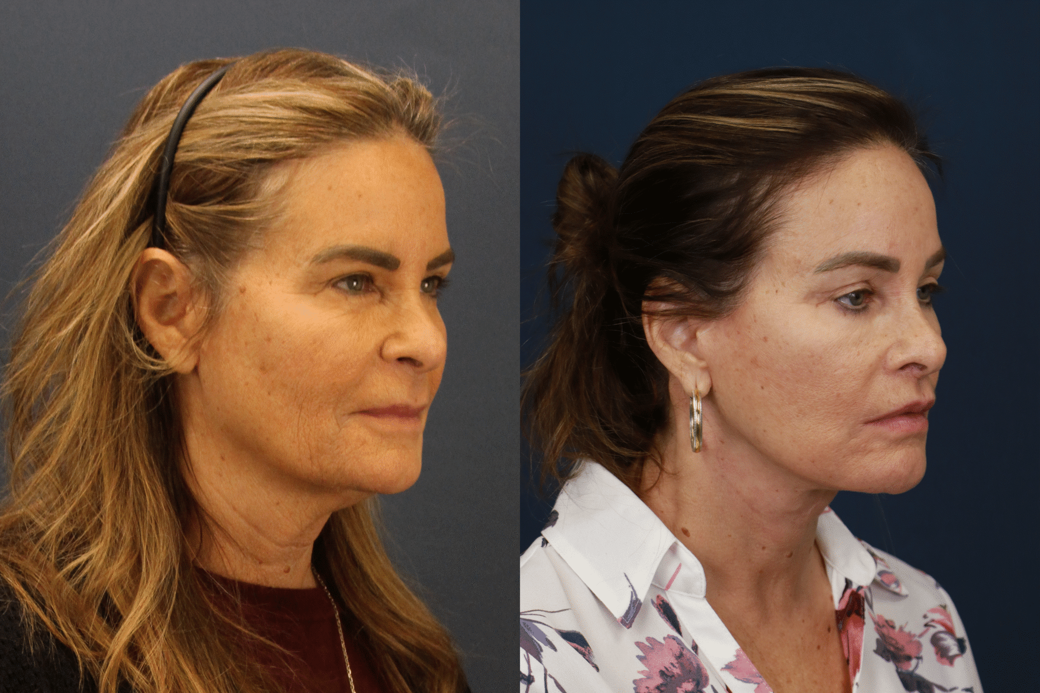 PamelaDeLozier2025 0102 002