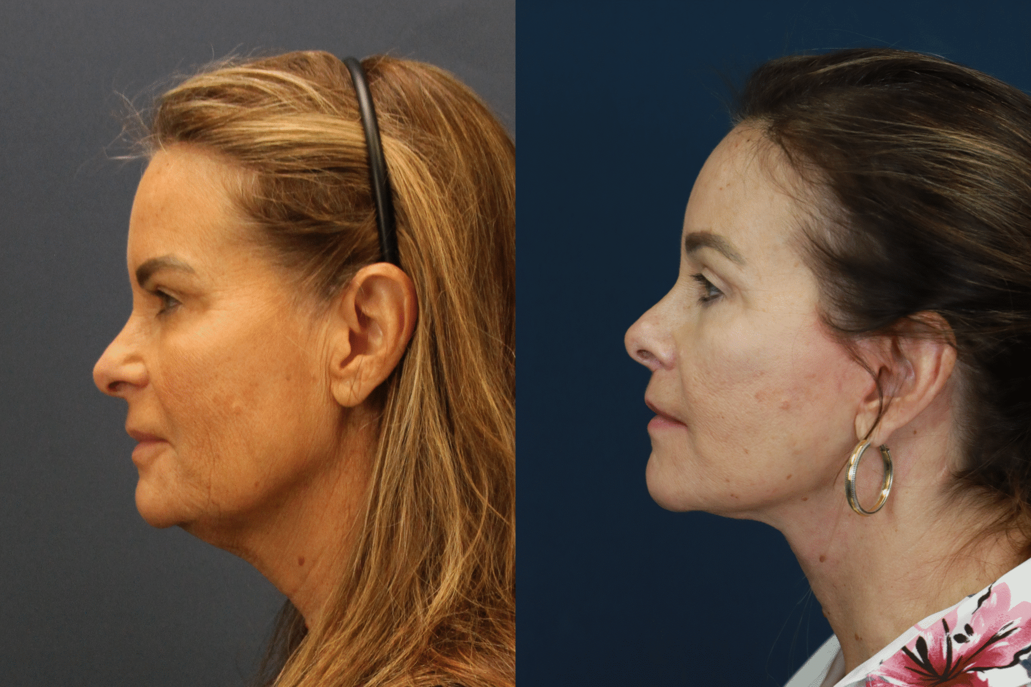 PamelaDeLozier2025 0102 004