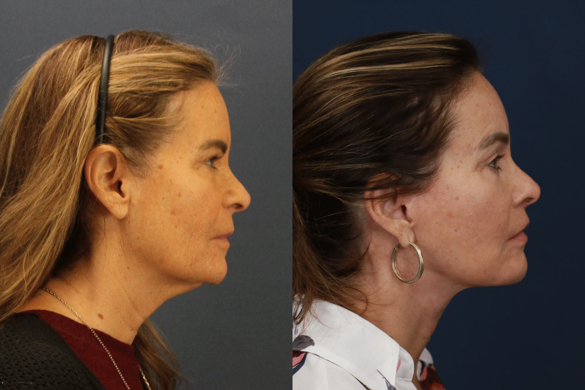 PamelaDeLozier2025 0102 006