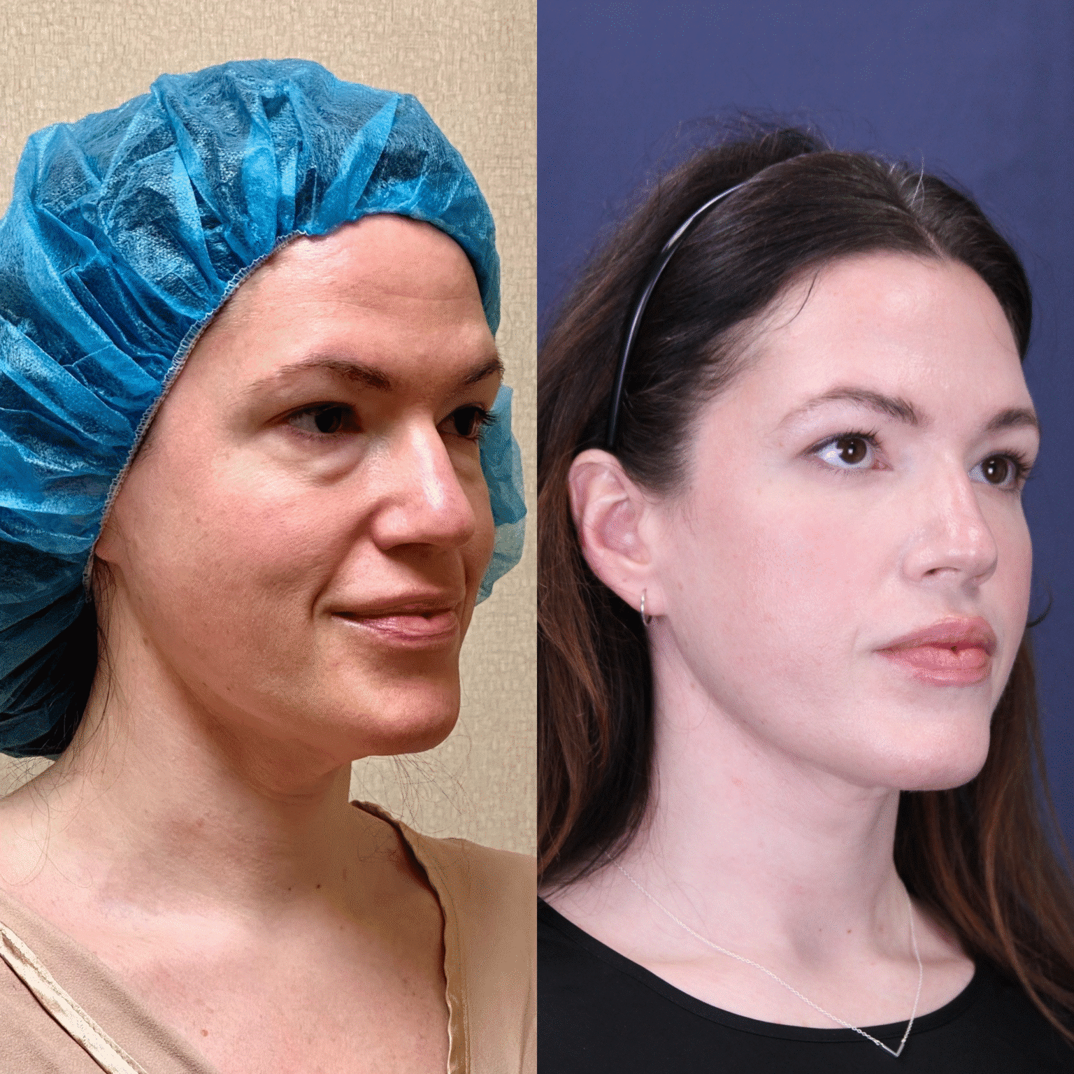 TICKET SENT Case10 angle right